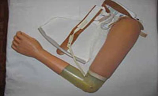 Active Shoulder Prosthesis for Upper Limb Replacement