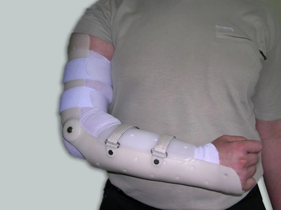 Custom Elbow Joint Apparatus for Rehabilitation