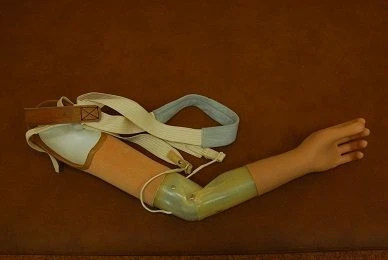 Active Arm Prosthesis with Mechanical Control