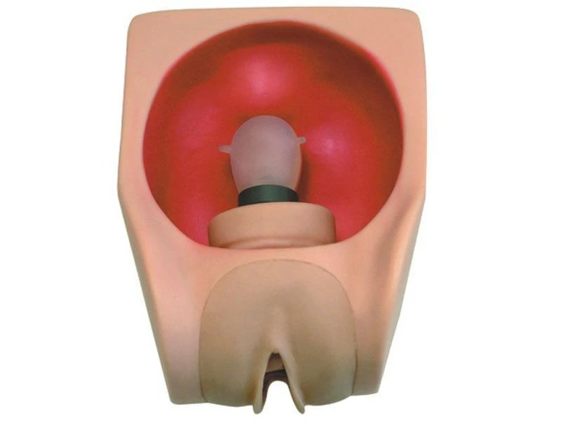 Advanced Female Contraceptive Model - T34B