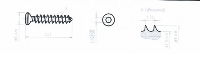 Titanium Alloy Spongy Screw with Full Thread 4.0mm x 14mm