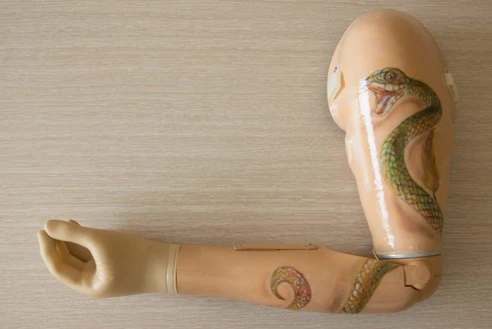 أطراف صناعية للذراع تعمل بمصدر طاقة خارجي