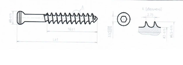 Titanium Alloy Spongy Screw 6.5mm, 16mm Thread, 60mm Length
