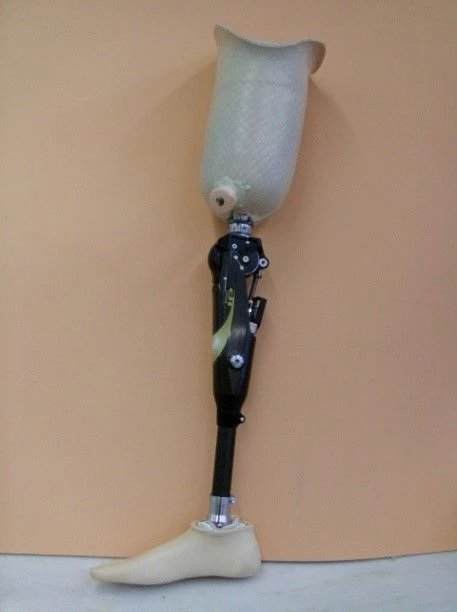 Modular Hip Prosthesis for Developmental Deficiency