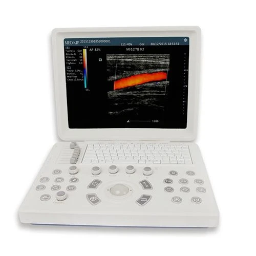 Color Doppler Ultrasound Machine Optim-DK