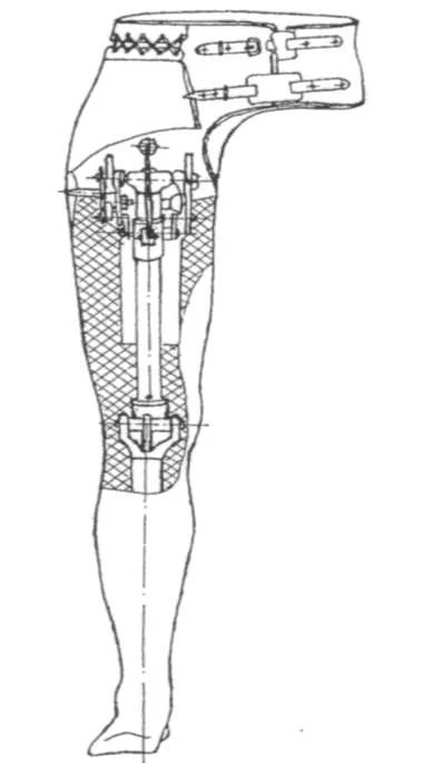 Non-Modular Thigh Amputation Prosthesis PN-VCHB