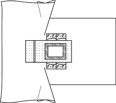Surgical Field Limiting Sheet with Cutouts for Urological Cystoscopy Procedures