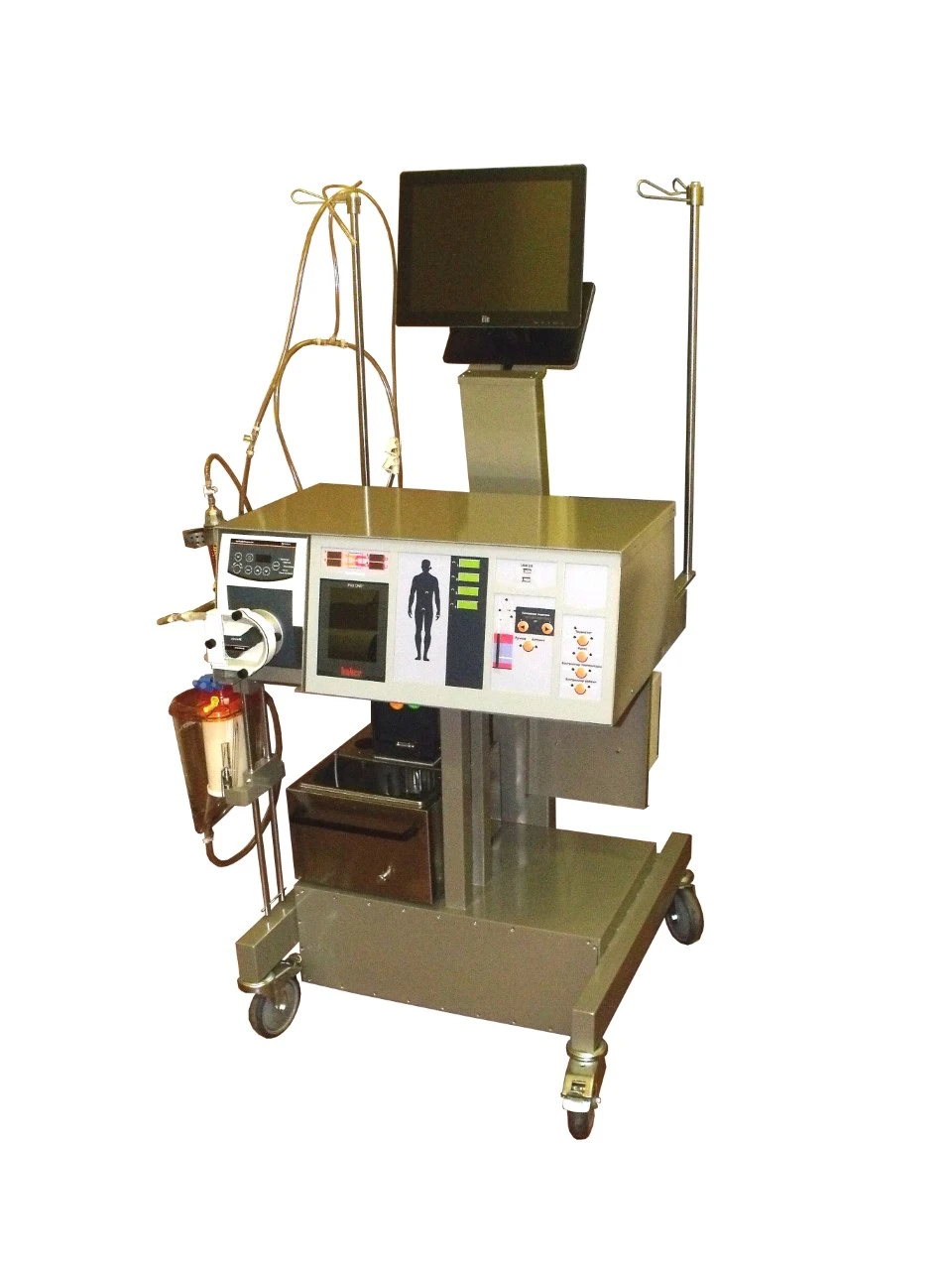 Medical Device for Hyperthermic Intraoperative Chemoperfusion - Khimioterm