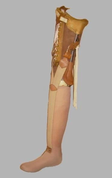 Non-modular Hip Prosthesis for Congenital Underdevelopment PN6-36