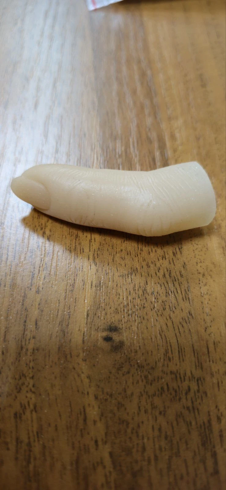 Cosmetic Finger Prosthesis for Amputation and Congenital Defects