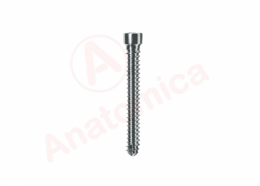 برغي قفل طرفي لكسور العظام