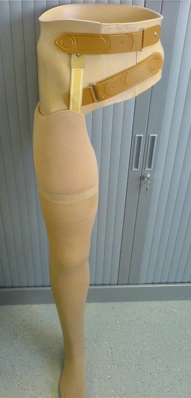 طرف اصطناعي متحرك للفخذ للأشخاص ذوي الإعاقات 8-07-11