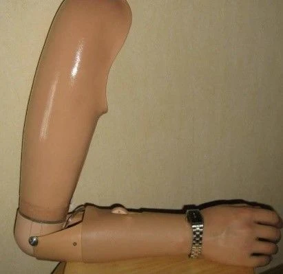 طرف صناعي وظيفي-تجميلي لبتر الكتف