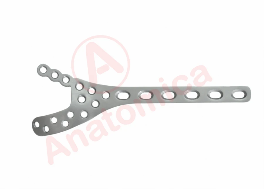 Distal Humerus Plate for Bone Fracture Stabilization