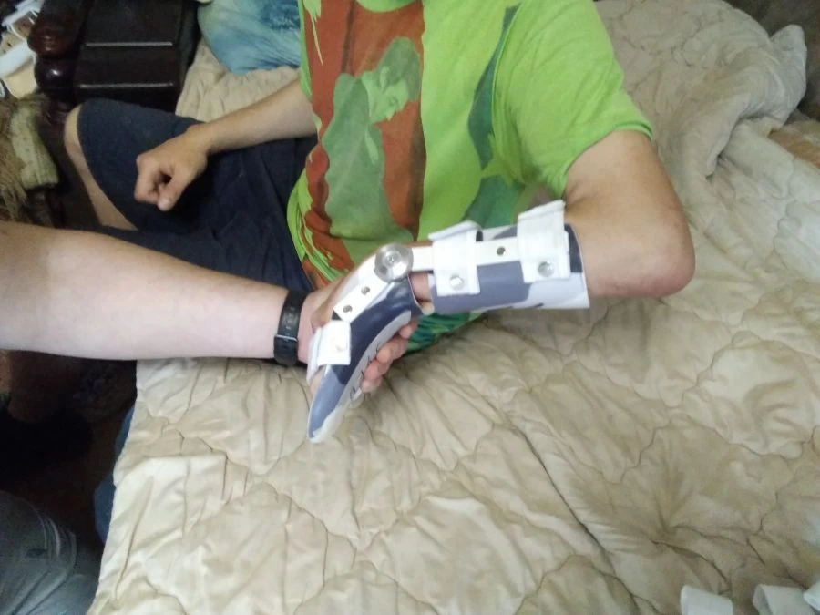 أجهزة تقويم مفصل الرسغ واليد