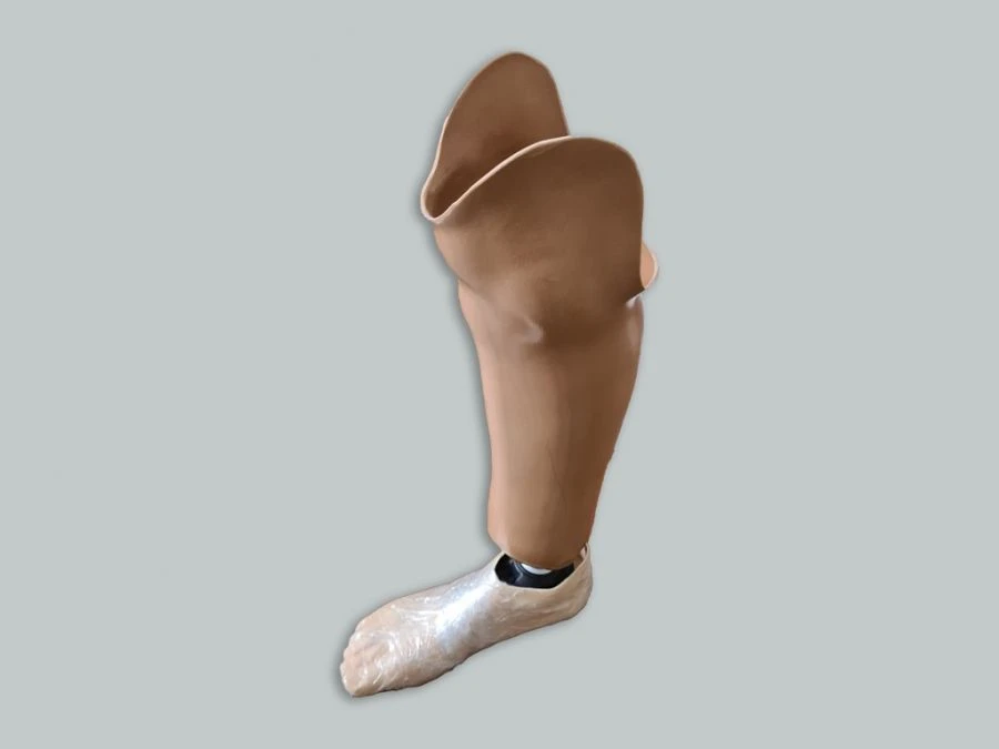 Modular Below-Knee Prosthesis for Underdevelopment Cases