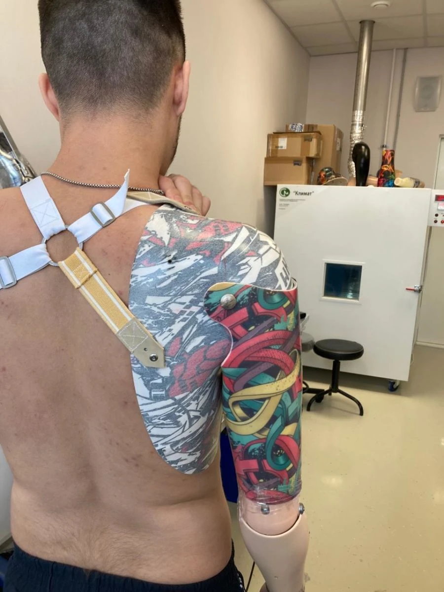 Microprocessor-Controlled Shoulder Prosthesis PR8-MVO
