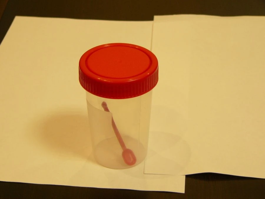 Disposable Non-Sterile Polymer Container for Biological Samples 150ml with Spoon - KOP