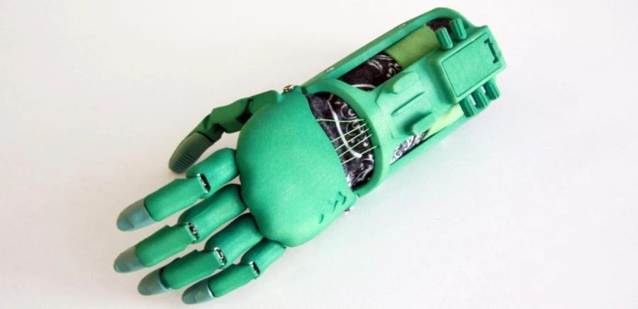 طرف صناعي نشط لليد عند البتر الجزئي