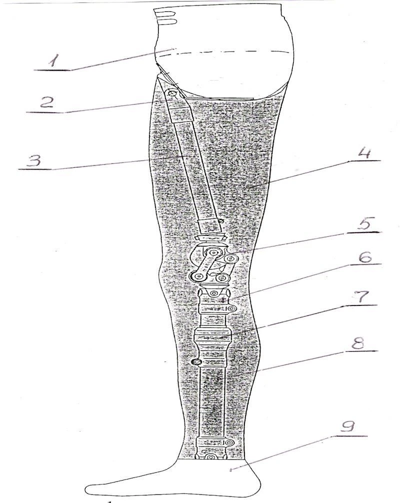 Modular Hip Disarticulation Prosthesis