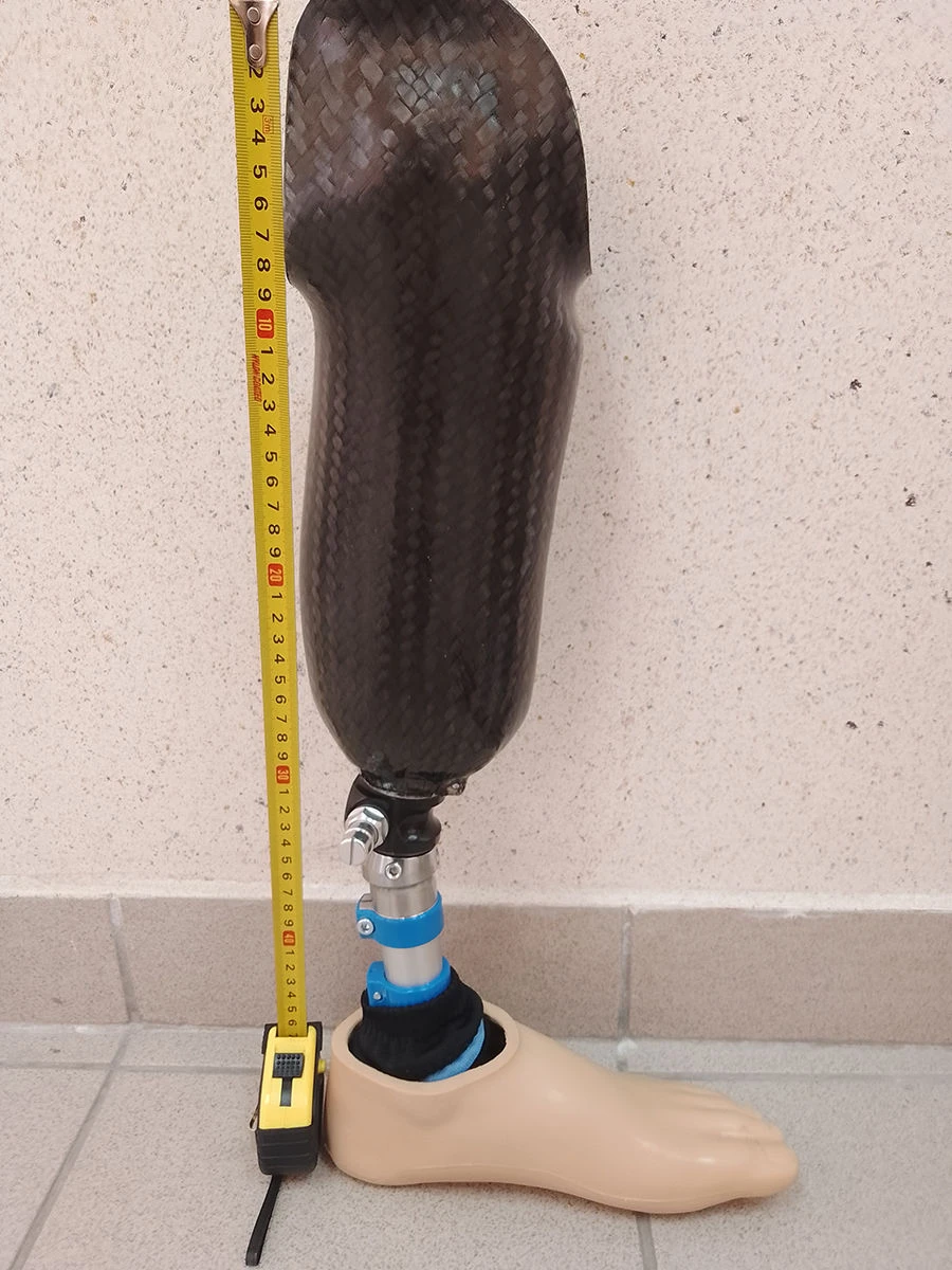 Modular Lower Leg Prosthesis for Individuals with Amputation or Congenital Defects 8-07-09
