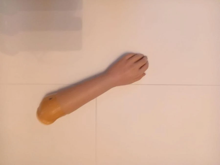 Cosmetic Forearm Prosthesis for All Ages and Genders