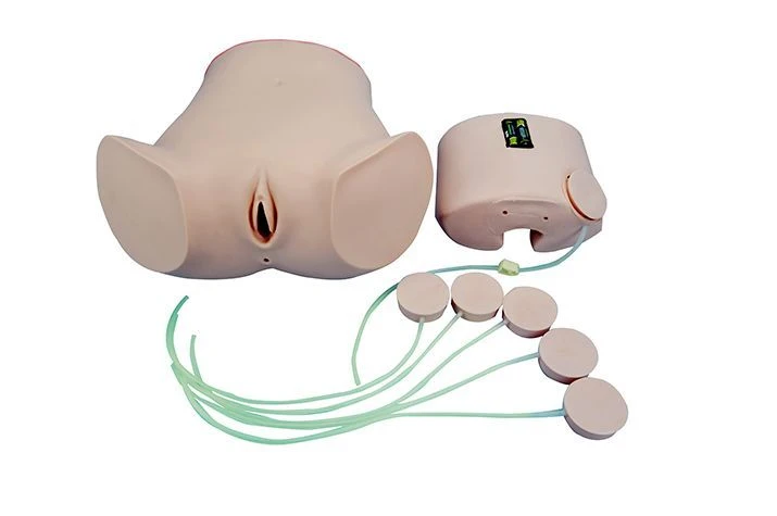 نموذج لعملية سحب السائل من تجويف البطن CS6232A