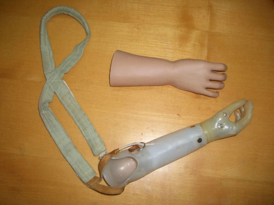 Active Forearm Prosthesis (Tension Type)