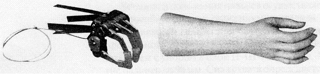 Active Hand Prosthesis (Traction Type) for Partial Hand Amputation