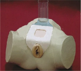 Female Bladder Puncture Model NS6047 / 29F