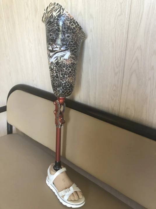 طرف صناعي للورك مودولاري للتطور غير الطبيعي