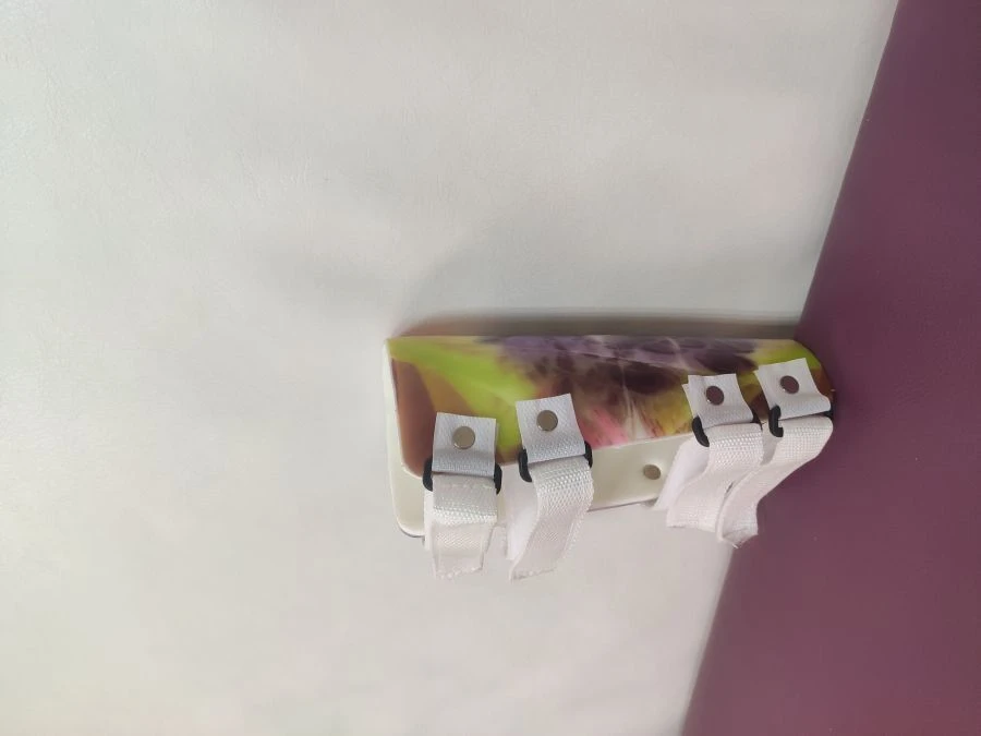 TR4-01 Custom Elbow Joint Brace for Rehabilitation