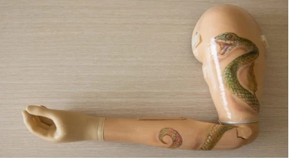 Microprocessor-Controlled Arm Prosthesis