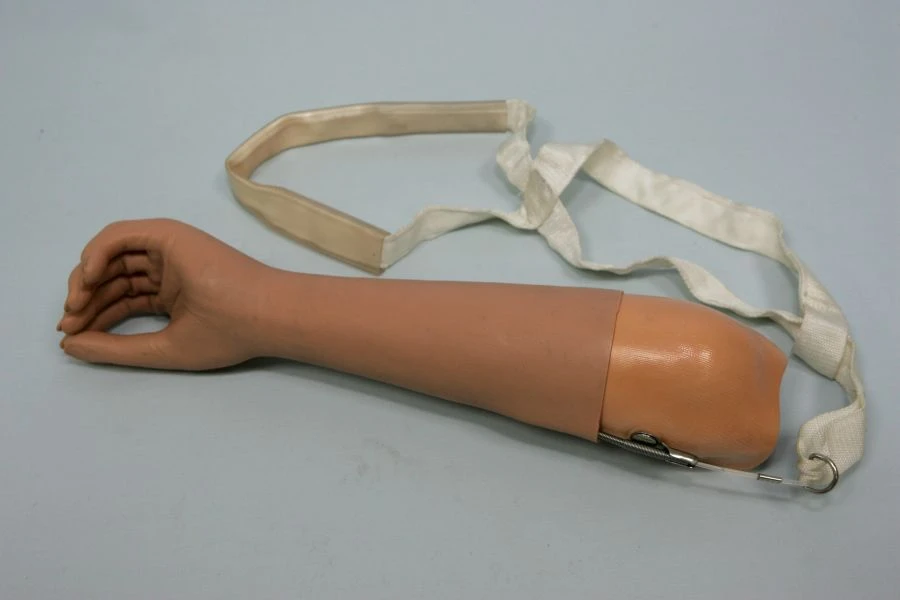 Active Forearm Prosthesis PR2-17 for All Age Groups