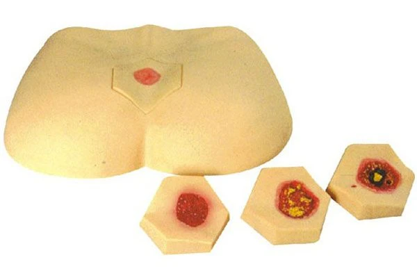 Pressure Ulcer Care Model Set with 4 Interchangeable Modules, 10B