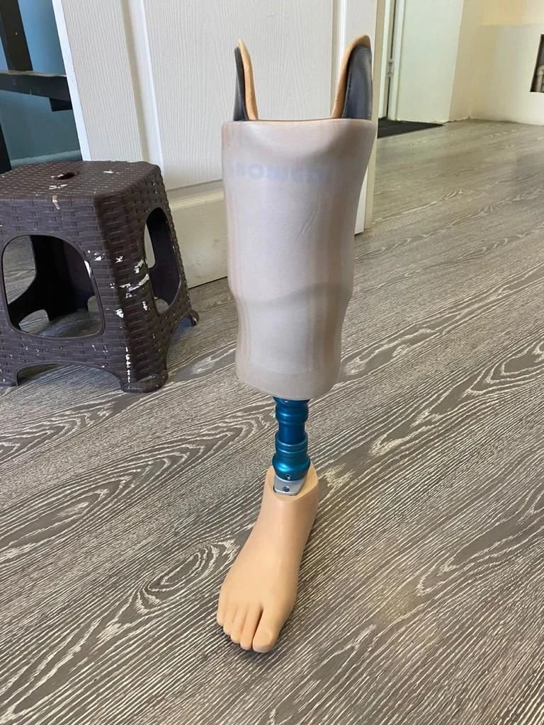 Custom Bath Prosthesis for Below-Knee Amputation PN3-M-K