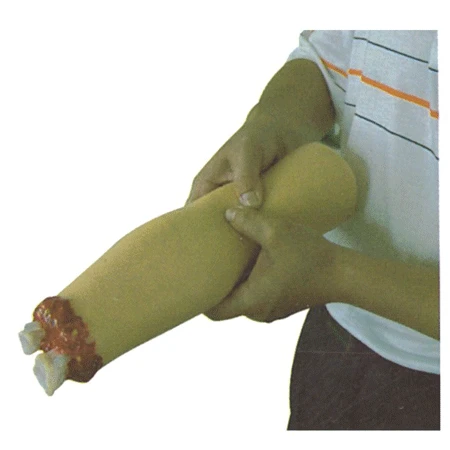 Life-Size Hand Model with Amputation Injury H2008 / FA6839