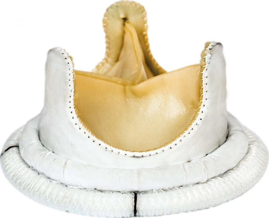 صمام قلب بيولوجي "ميدينج-بيو" (أبهري)