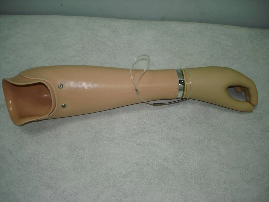 Active Forearm Prosthesis PV-PRT for All Age Groups