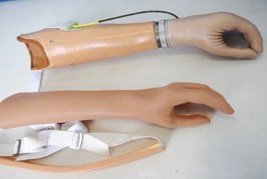 Active Forearm Prosthesis (Tensile Type)
