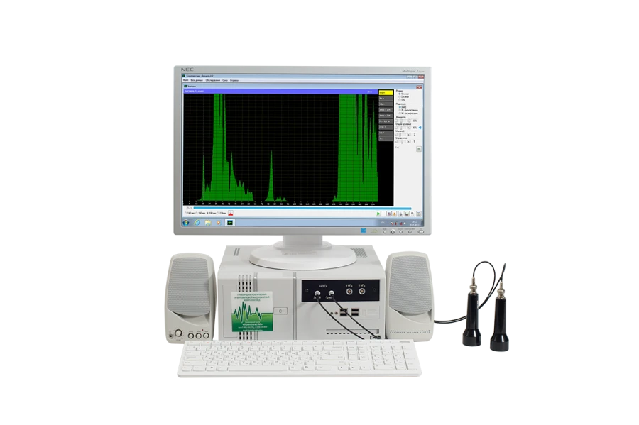 Computerized Dual-Channel Echoencephalograph "Kompleksmed" Version 3.1