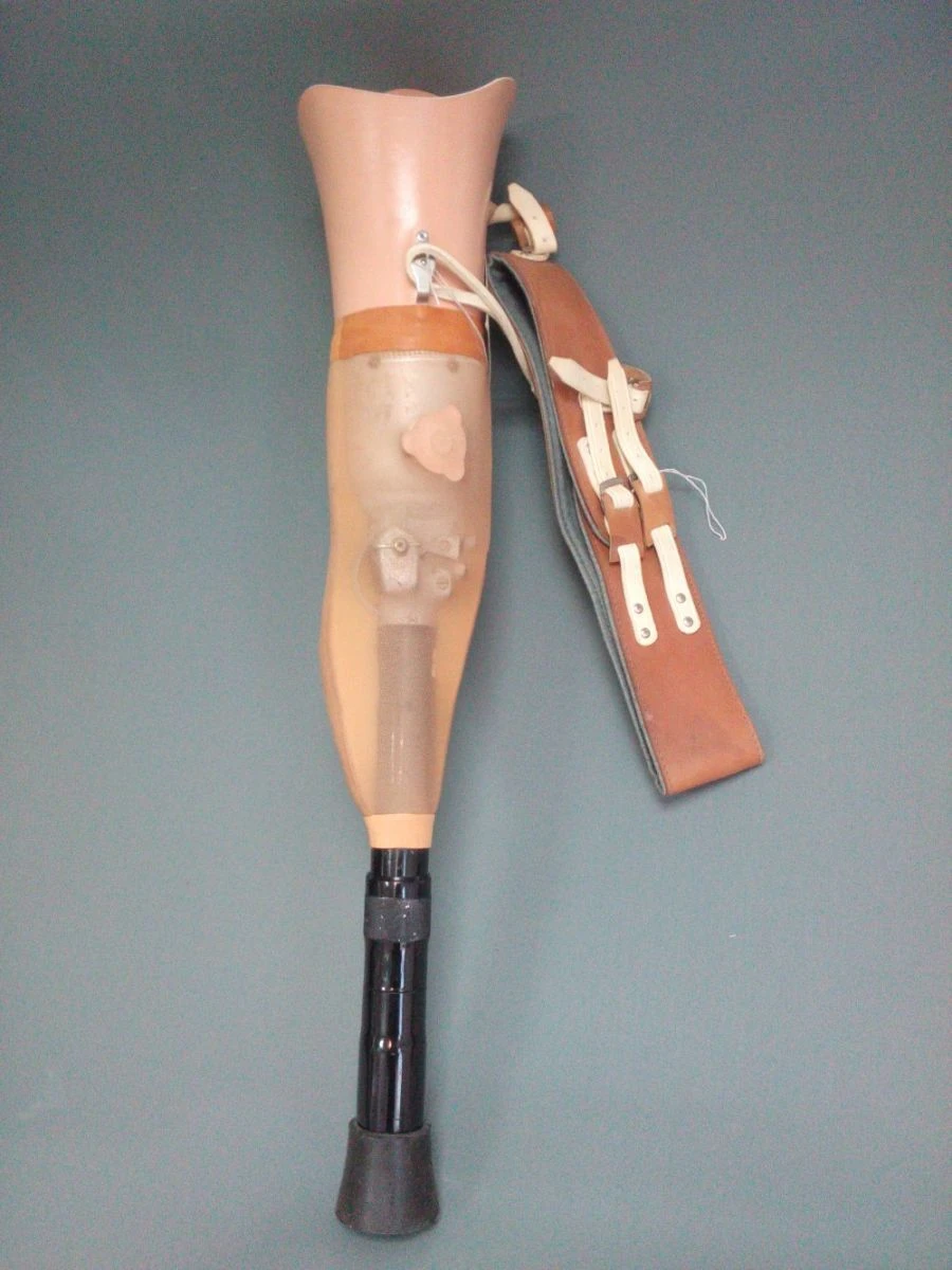 Non-Modular Hip Prosthesis for Congenital Underdevelopment