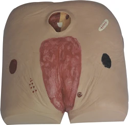 Pressure Ulcer Care Model for Elderly, Model 10