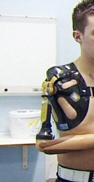 Electromechanical Shoulder Prosthesis with Contact Control System