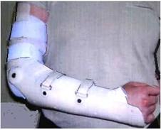 Wrist and Elbow Joint Treatment Device