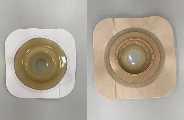 Rehabilitation Device for Stoma Use: Flat and Convex Plates