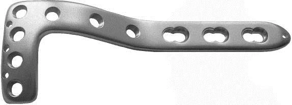 لوحة على شكل L لكونديل جانبي مع 3-5 ثقوب، يمين/يسار