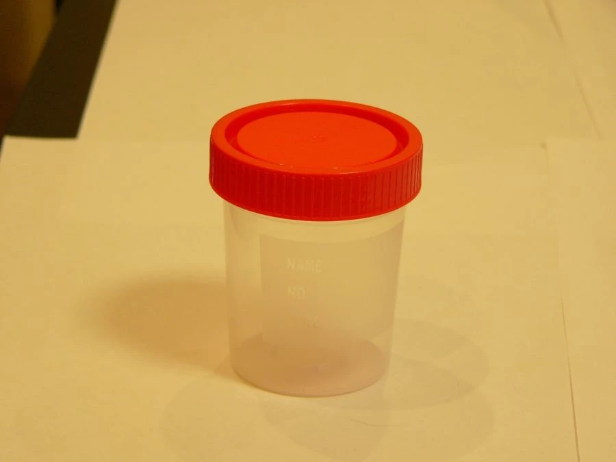 Disposable Non-Sterile Polypropylene Container for Biological Samples - KOP 125ml/K