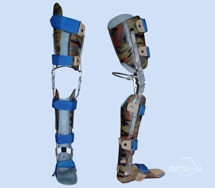 Advanced Orthopedic Full Leg Apparatus with Custom Shells