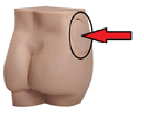 Mannequin Insert for KAP/T1 Model